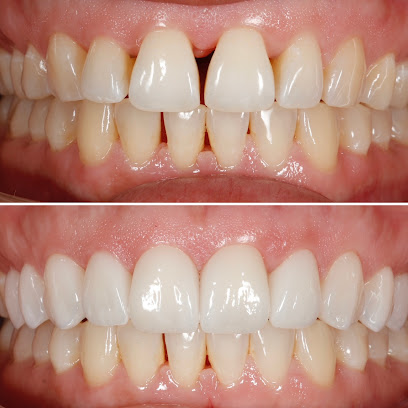 Brunswick Smiles Family Dentistry | Implant, Oral Surgery, and Cosmetic Dentist in South Brunswick image